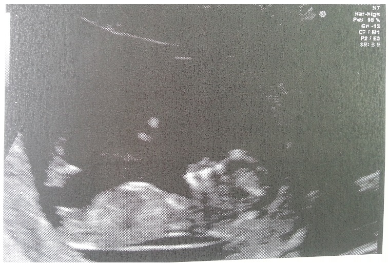 duotest_manineprofilo